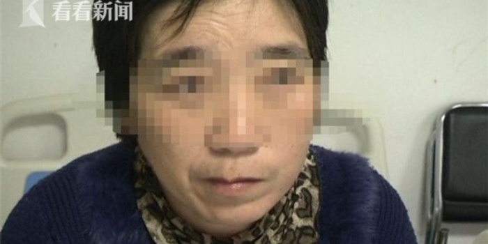 女子骑车上班因头发未干引发风寒面瘫
